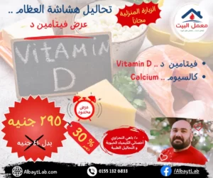 تحاليل هشاشة العظام .. عرض فيتامين د